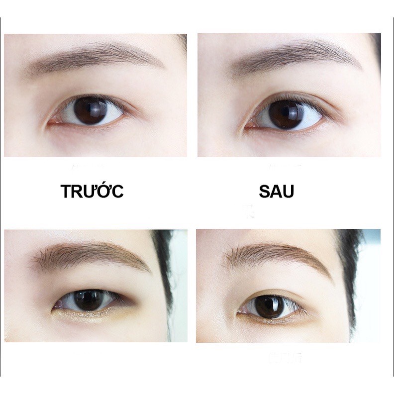 Kích mí tàng hình tạo hai mí không lộ sẵn keo nhiều lựa chọn