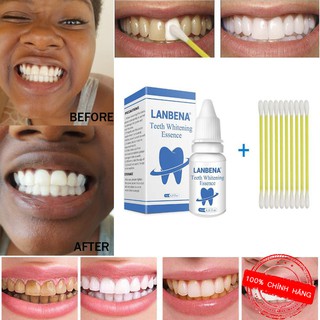 Tinh chất tẩy trắng răng lanbena làm sạch răng khử mùi hôi whitening teeth essence 10ml