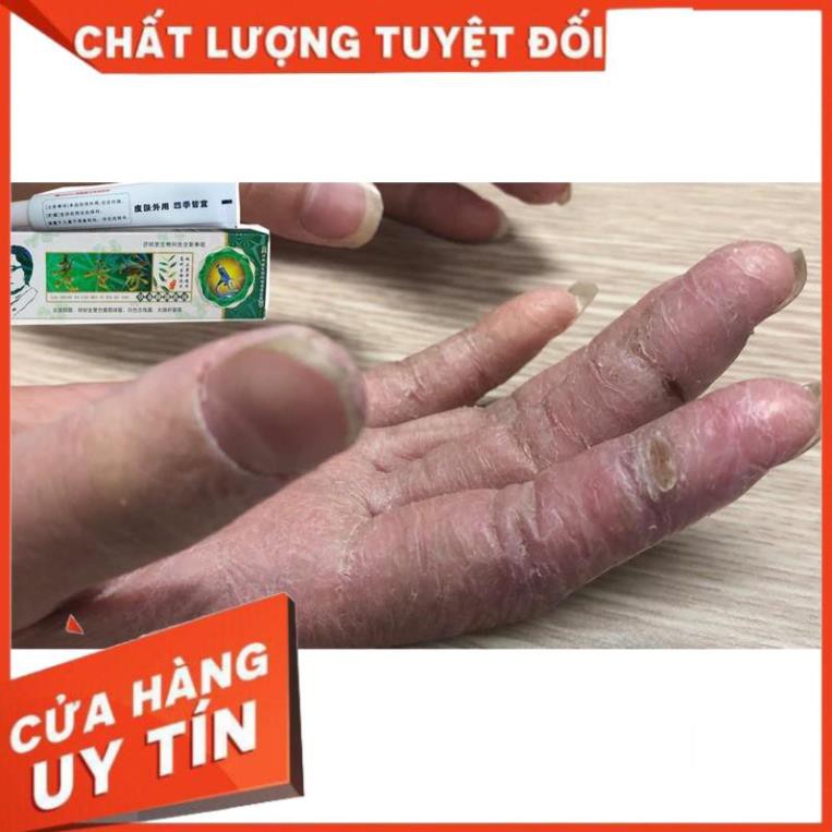 [FreeshipMax] Kem Bôi Ngoài Da Chống Nứt Nẻ Bong Tróc Khô Da Cực Hiệu Quả