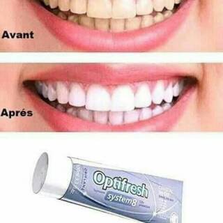 Dụng cụ làm trắng răng ANTIFRESH SYSTEM 8