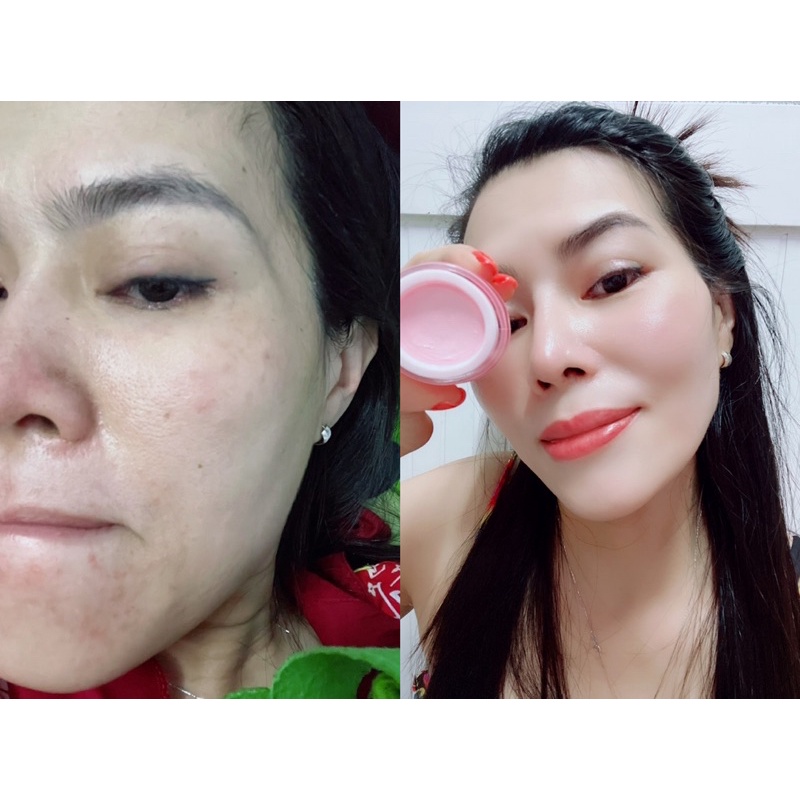🥇KEM FACE 2 TẦNG MYÔ (kem dưỡng trắng da đa năng)