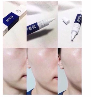 Kem dưỡng trị lão hoá