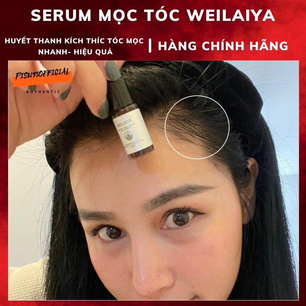 [FREESHIP] Serum huyết thanh tóc Weilaiya, kích mọc tóc ngăn rụng tóc - Hàng chính hãng