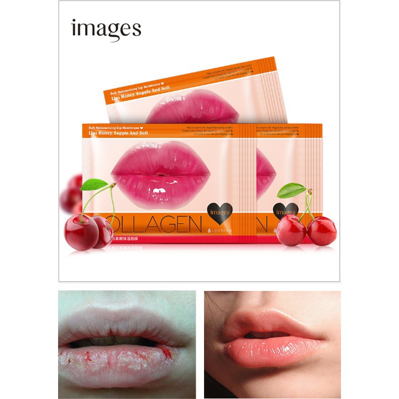 Mặt Nạ Môi Collagen Cherry Images Giúp Môi Mềm Mại Hồng Hào Cằn Bóng Dưỡng Cấp Ẩm Cho Môi ILY