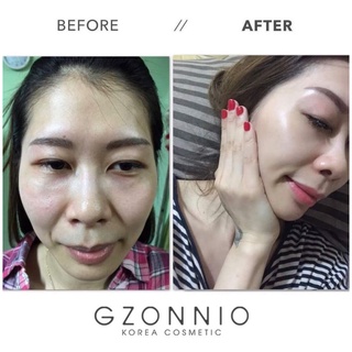 Bộ sản phẩm Gzonnio