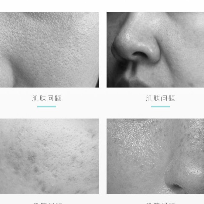 Gel tẩy tế bào chết Fumeling Centella cho da mặt nội địa trung | BigBuy360 - bigbuy360.vn