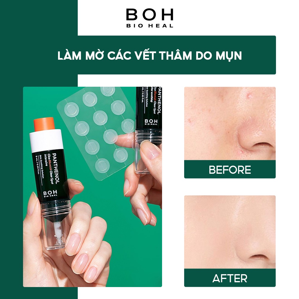 Bộ Sản Phẩm Chăm Sóc Da Mụn BIOHEAL BOH Panthenol Cica Blemish Clear Spot 9ml* 2 (NEW)