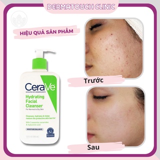 ✅[Chính Hãng] Sữa rửa mặt Cerave Hydrating (Xanh lá 236ml)