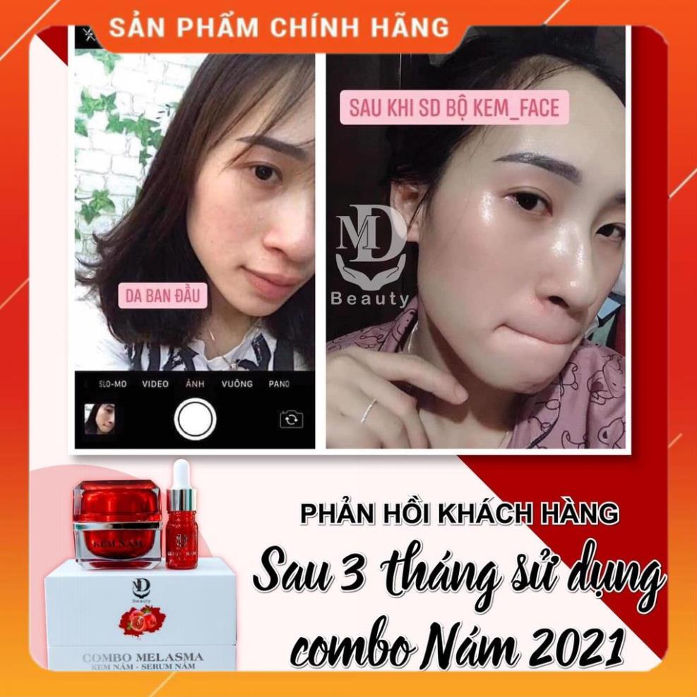 Kem Face Nám Lựu Đỏ MD Beauty Dưỡng Trắng Da, Loại Bỏ Mụn Nám Tàn Nhang