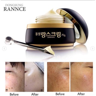 Kem dưỡng DONGSUNG Rannce Cream