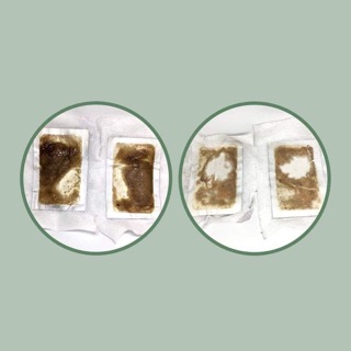 Dermax relax healing patch miếng dán giảm cân