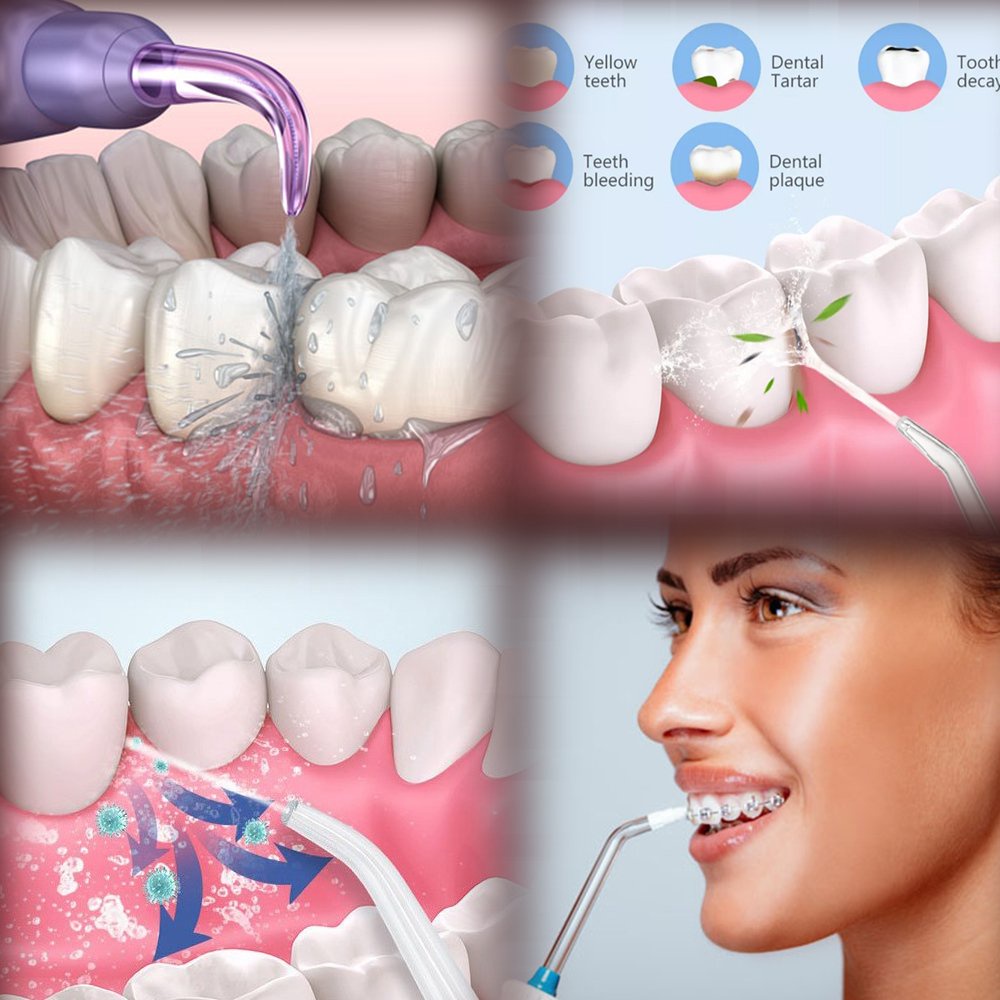 Máy Tăm Nước cầm tay không dây 3 chế độ vệ sinh răng miệng cực sạch nhập khẩu Chính Hãng tặng kèm 4 đầu phun