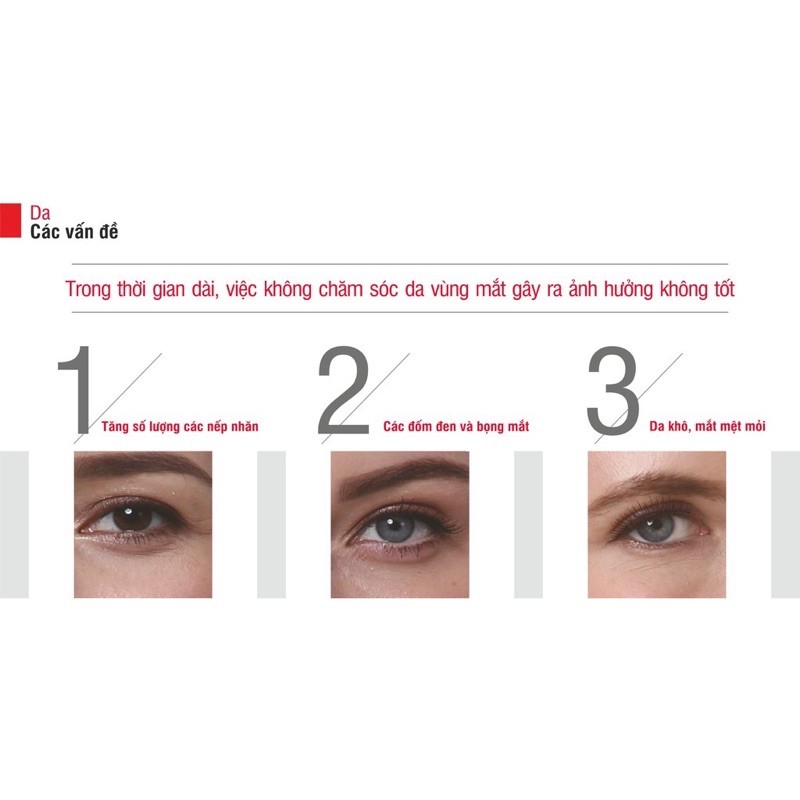 Máy massage mắt cầm tay Lifetrons EM-100 mát xa đẩy tinh chất trị mỏi mắt thâm mắt giảm nếp nhăn chống lão hóa