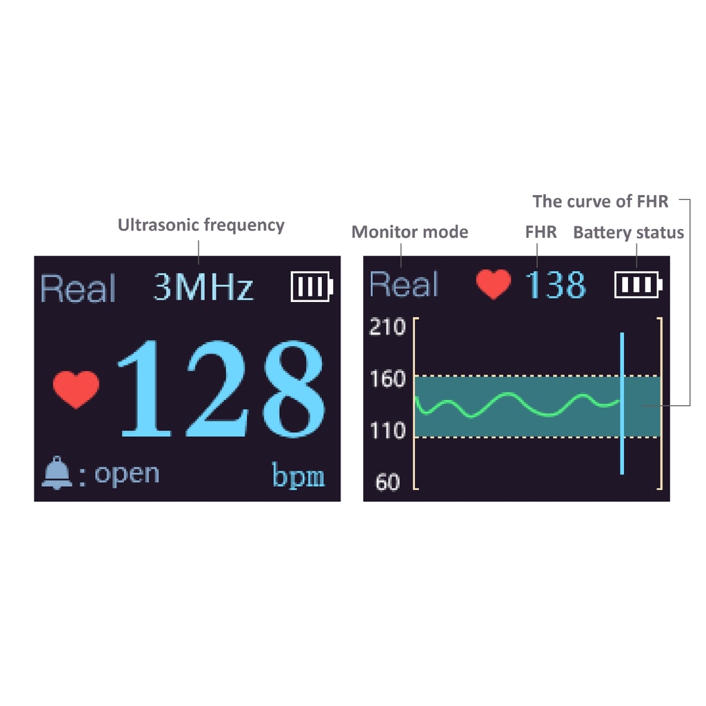 Máy đo nghe tim thai cá nhân cầm tay Jumper JPD-100B