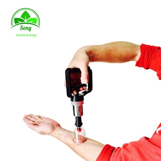 Bộ giác hơi không dùng lửa YGH02