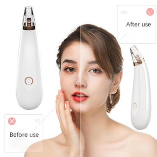 Máy Hút Mụn Mini Cầm Tay Cao Cấp New 2019 [Loại 1]