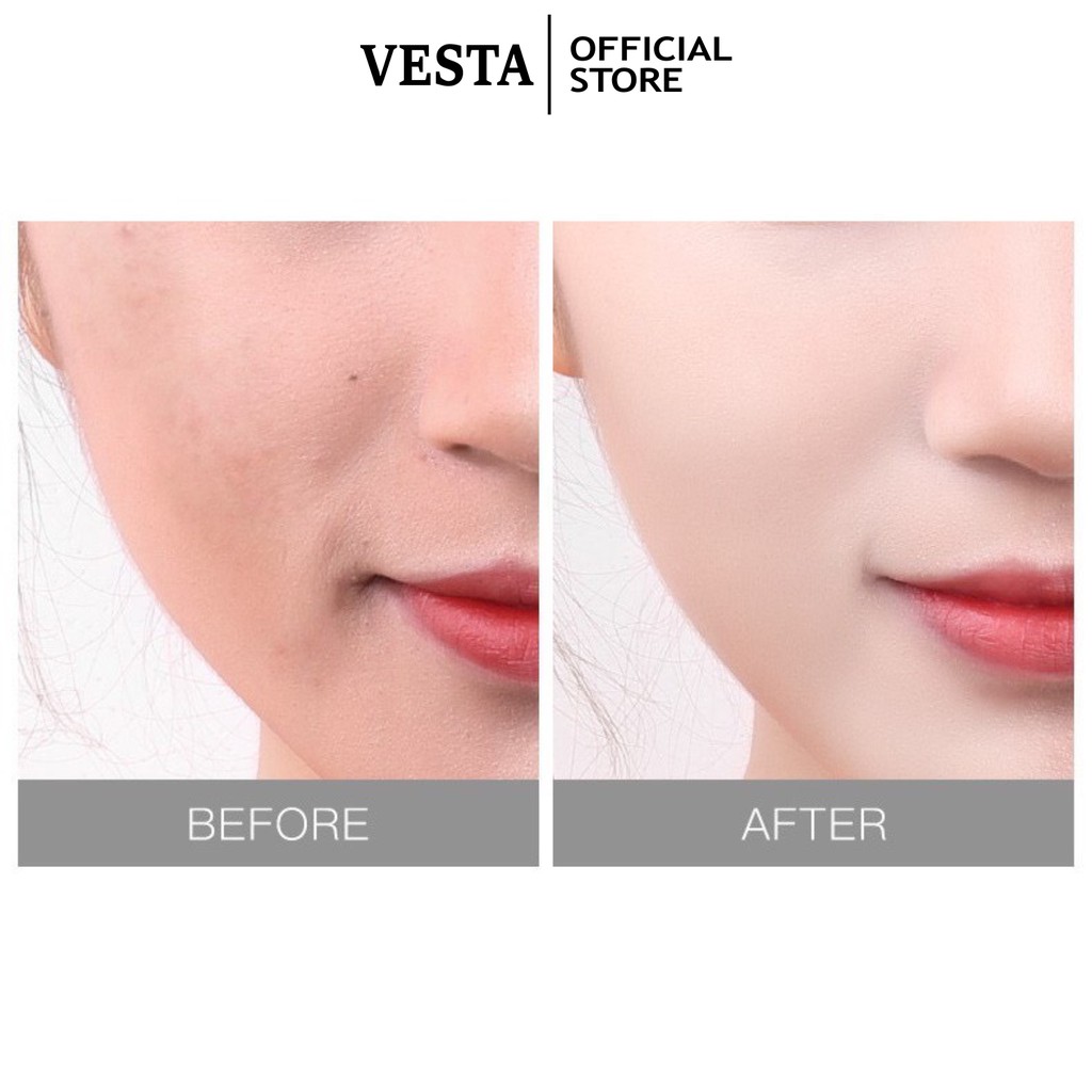 Mặt Nạ Giấy 3W Clinic Dưỡng Ẩm Trắng Da Giảm Mụn Fresh Mask Sheet Chăm Sóc Da Toàn Diện 23ml