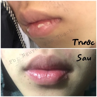 Serum Dưỡng môi Eveline 8in1 mới
