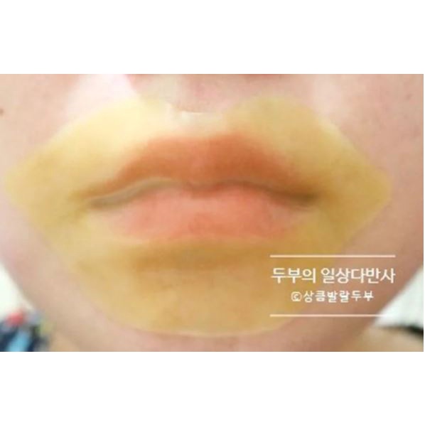 [Hộp 30 Miếng] Mặt Nạ Miếng Dưỡng Môi Mềm Mịn Berrisom SOS Lip Patch 80g