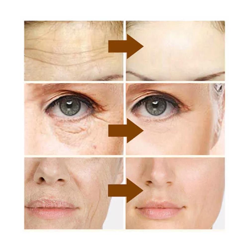 (Hàng Mới Về) Serum Dưỡng Da Mặt Chống Lão Hóa Và Nếp Nhăn | BigBuy360 - bigbuy360.vn