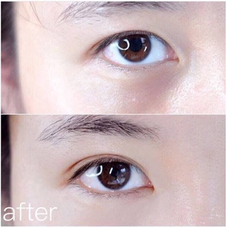 Serum Mắt The Ordinary Caffeine Solution 5% + EGCG