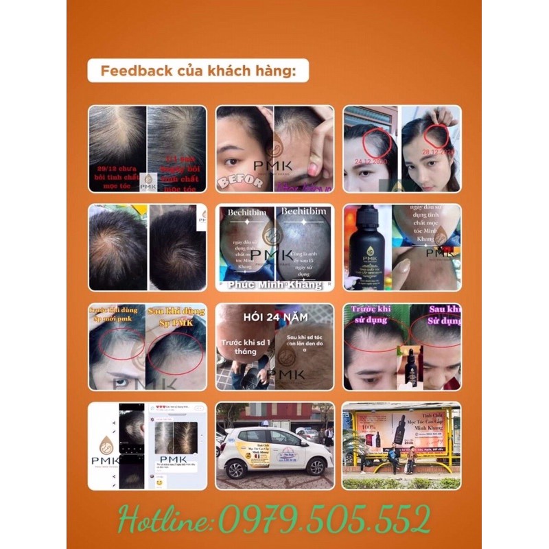Tinh chất mọc tóc Cao Cấp Phúc Minh Khang
