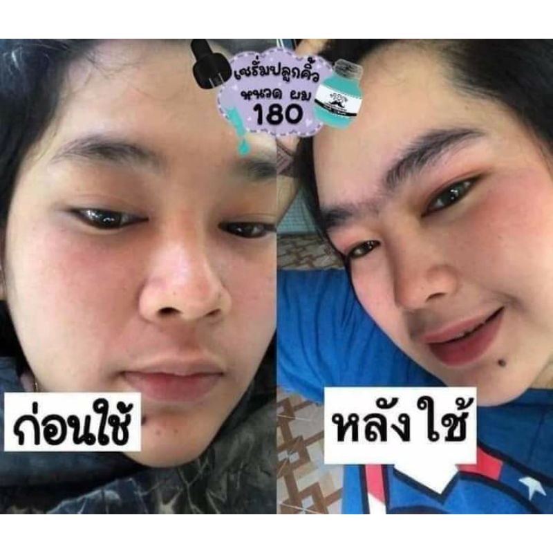 💜Cute so Cute hair 👨serum mọc râu lông may, lông ria , lông  mép ✅.