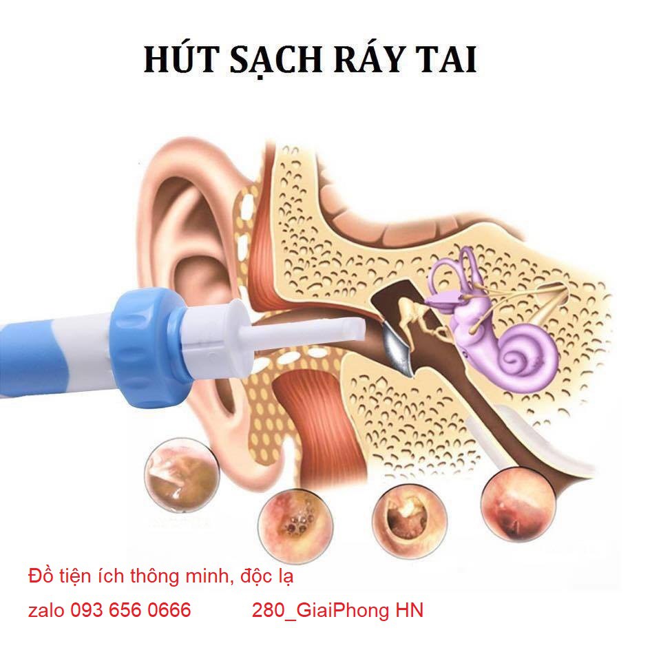 Dụng cụ lấy ráy tai thông minh nhiều đầu - Bộ Lấy Ráy Tai Công Nghệ Nhật Bản