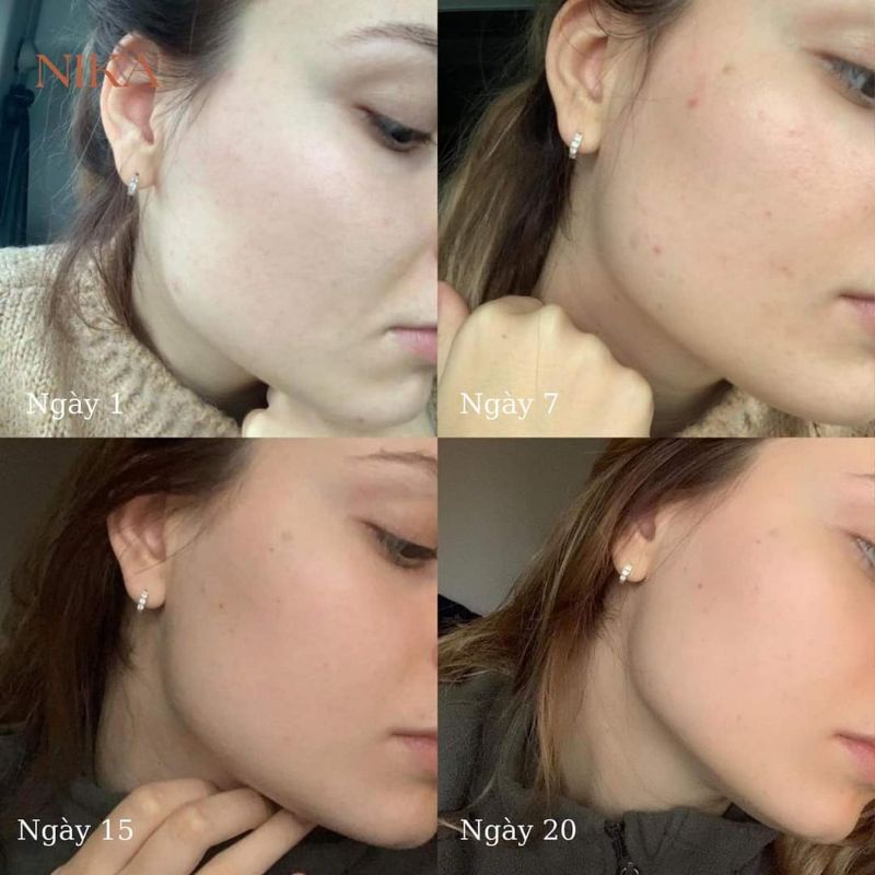 Serum Placenta Tinh chất tăng cường phục hồi da