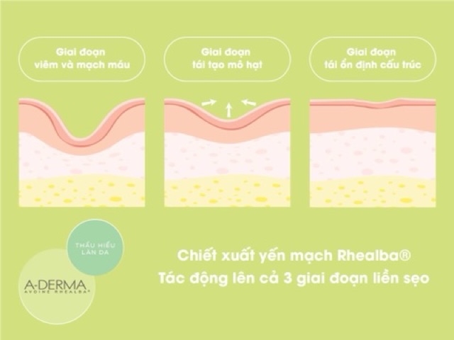 [NHẬP KHẨU] Kem dưỡng liền sẹo, tái tạo da, chống thâm ADERMA EPITHELIALE A.H DUO [A-Derma Epitheliale A.H Dou]