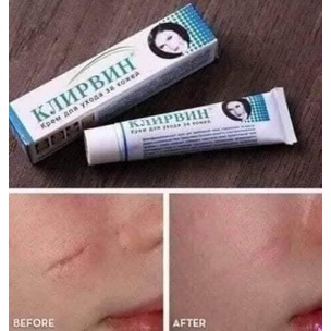 Kem Sẹo Nga Klirvin giảm thâm và sẹo phục hồi da 25gr