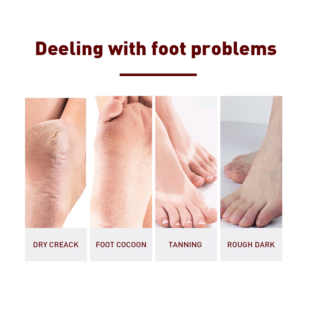 Mặt Nạ Chân Breylee Dưỡng Ẩm Làm Trắng Da