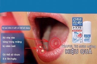 😀xịt trị nhiệt miệng của Nhật 20ml