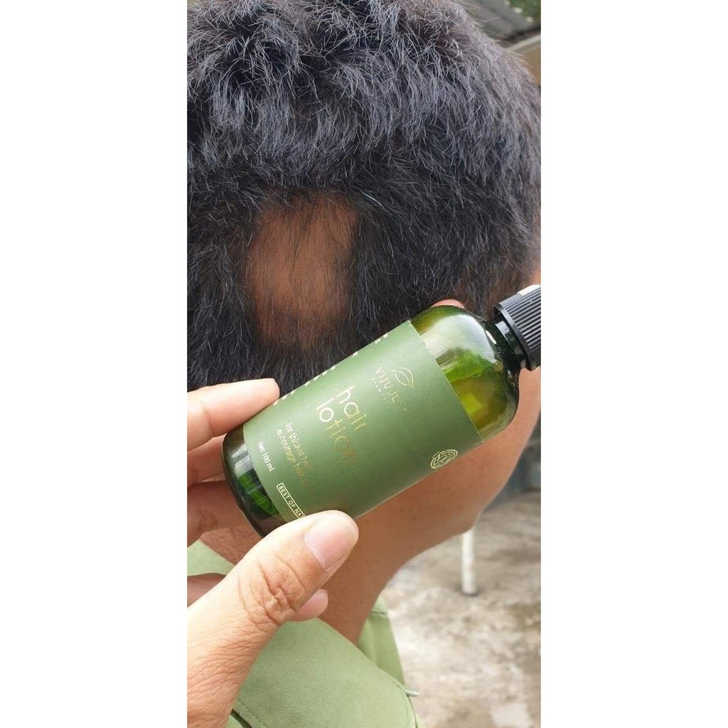 [ Tặng Cột Tóc + Date Mới ] Tinh Dầu Bưởi Vy Jully Giúp Gẫy Rụng Và Mọc Tóc Con 100ml | BigBuy360 - bigbuy360.vn