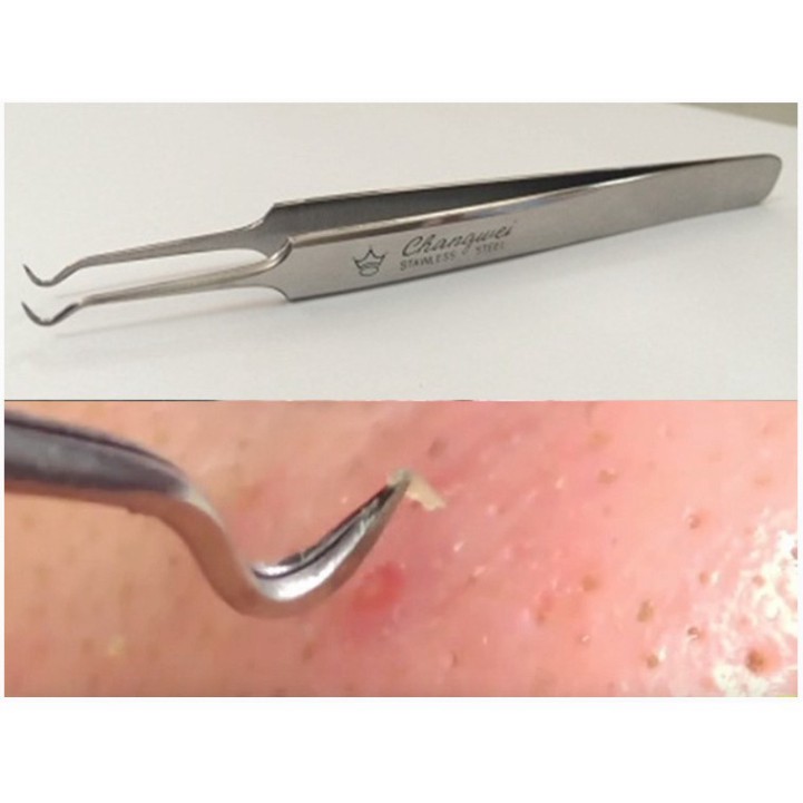 Nhíp Gắp Mụn Đầu Đen Vacosi T07