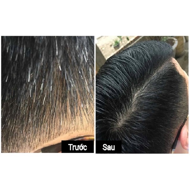 Nhuộm tóc dược liệu Thái Dương | BigBuy360 - bigbuy360.vn