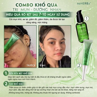 combo dưỡng nhan tái tạo da sạch mụn ngừa thâm_