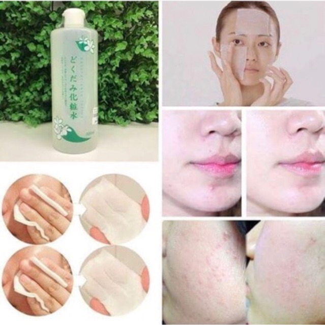 NƯỚC CÂN BẰNG RAU DIẾP CÁ DOKUDAMI NATURAL SKIN LOTION