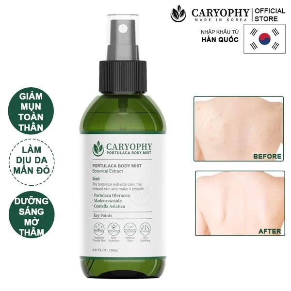 Xịt mụn lưng Caryophy portulaca giảm mụn mờ thâm 150ml NPP Tido88