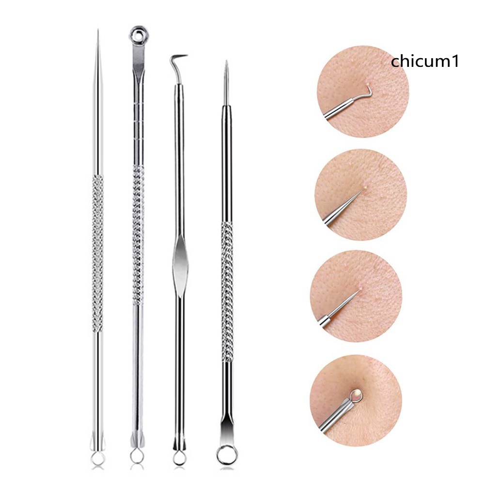 [Hàng mới về] Bộ 4 Kim Nặn Mụn Đầu Đen Dễ Dùng Tiện Lợi Thân Thiện Với Làn Da