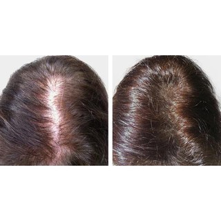 Dầu Gội Avalon Organics Có Chứa Biotin