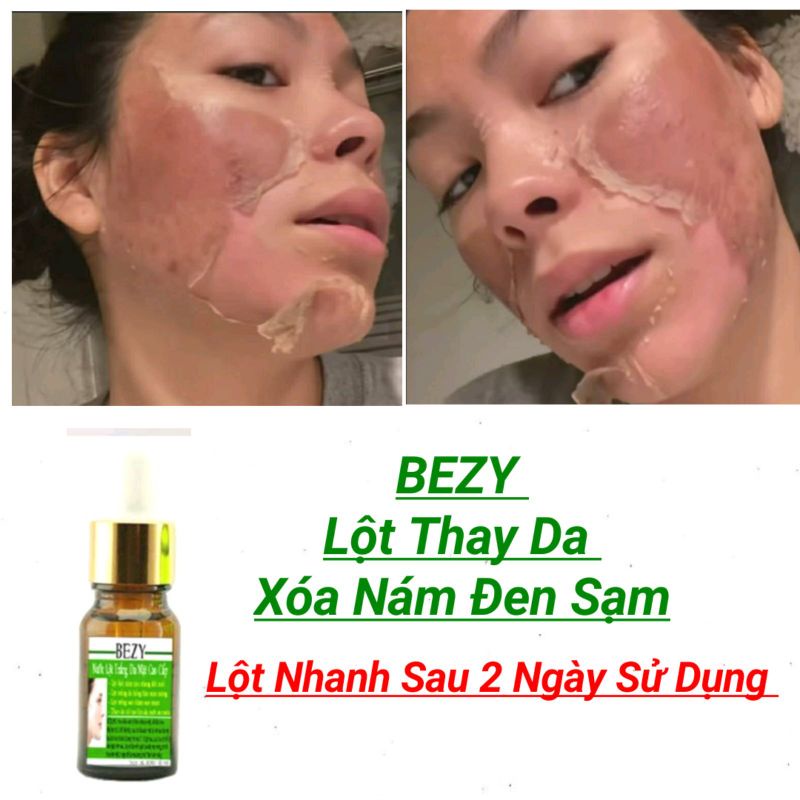 Lột Bong Da Mặt Trắng Da Nam Nữ Bezy
