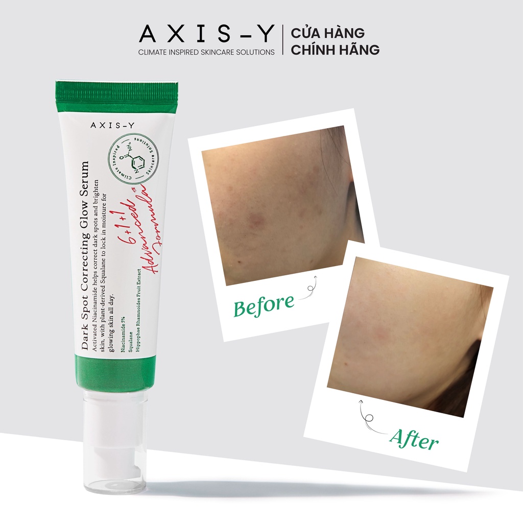 Tinh chất làm sáng mờ thâm Niacinamide 5% Axis-Y Dark Spot Correcting Glow Serum 50ml.