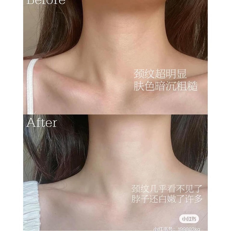 [ĐỦ BILL U.S SỈ LẺ] Kem dưỡng cho vùng da cổ và ngực Gold Bond | BigBuy360 - bigbuy360.vn