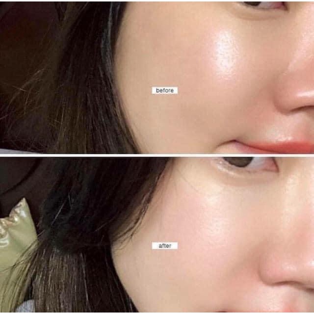 Tinh Chất Trắng Da MEDI-PEEL Serum Gluthione 600 White Ampoule Medi Peel