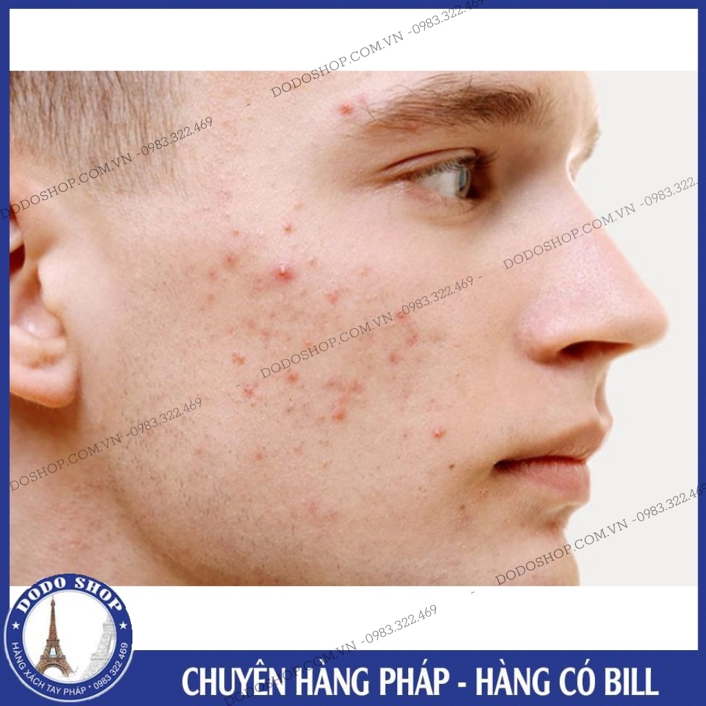 (Date 7/2022) Gel Papulex chấm mụn tại chỗ -Papulex Gel