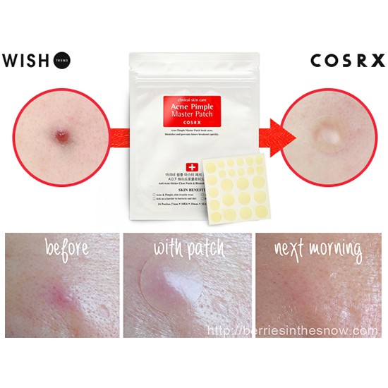 Miếng dán mụn COSRX Acne Pimple Master 24 miếng dán