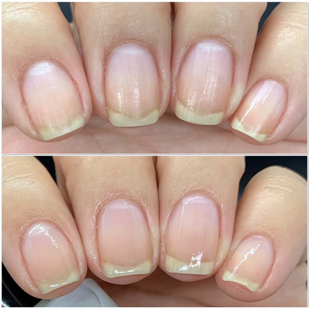 [BASEFILLER] Dưỡng Lót Ridge Filler Primer 15ML | BigBuy360 - bigbuy360.vn