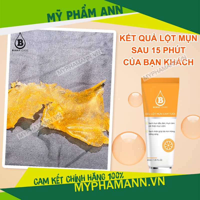 Gel Lôt Mụn Cám Mụn Đầu Đen Benny Care - Lột Mụn Cam Tươi MD Beauty