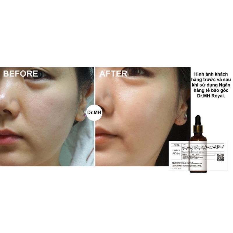 Serum tế bào gốc Dr.MH Royal Stem Cell - Hàng chính hãng